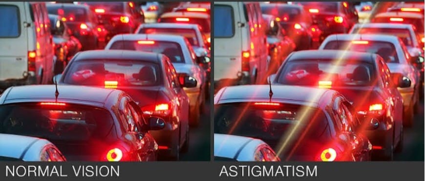 astigmatism vision comparison 